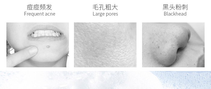 ��������b